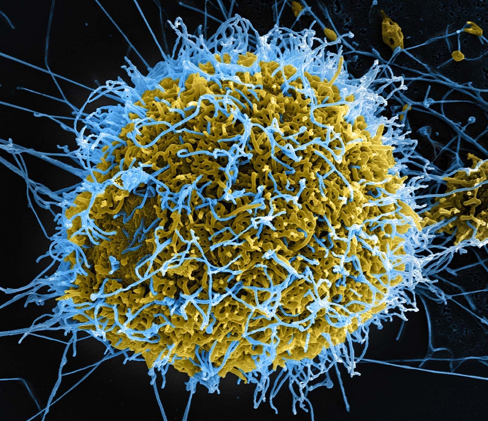 Ebola pandemic in 2026? market image